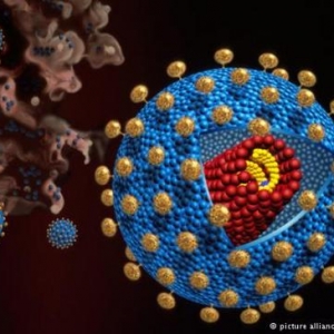 预防艾滋病毒 美国科学家迈出一大步